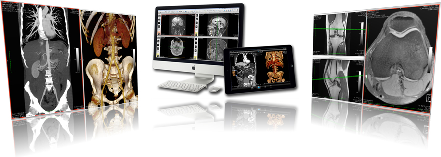 海外遠隔画像診断 遠隔読影 セカンドオピニオン